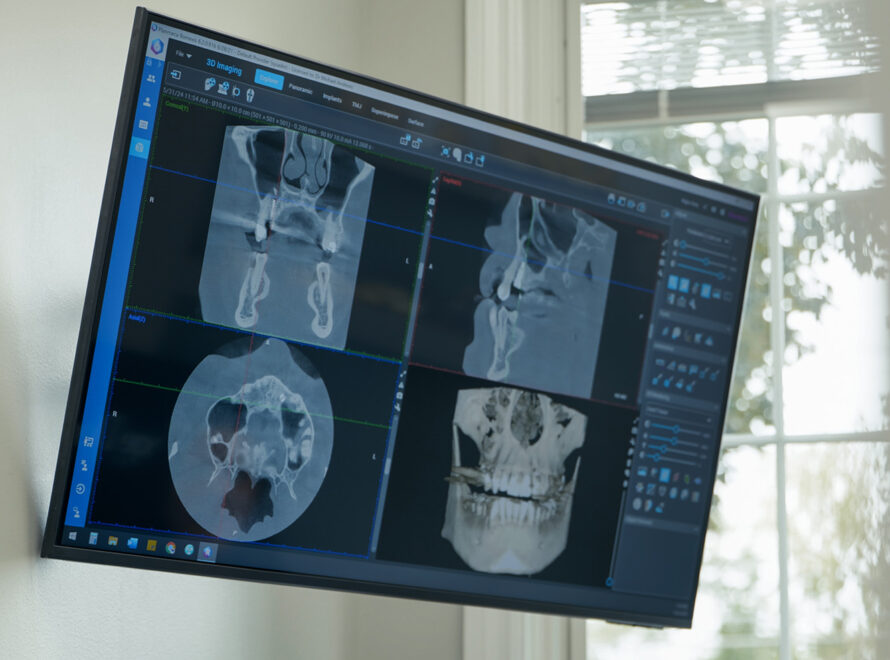 Milford MI Dental Implant Dentists