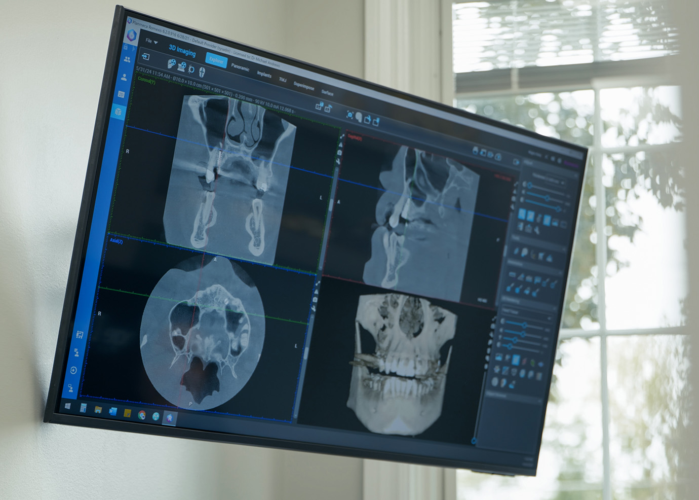 Milford MI Dental Implant Dentists